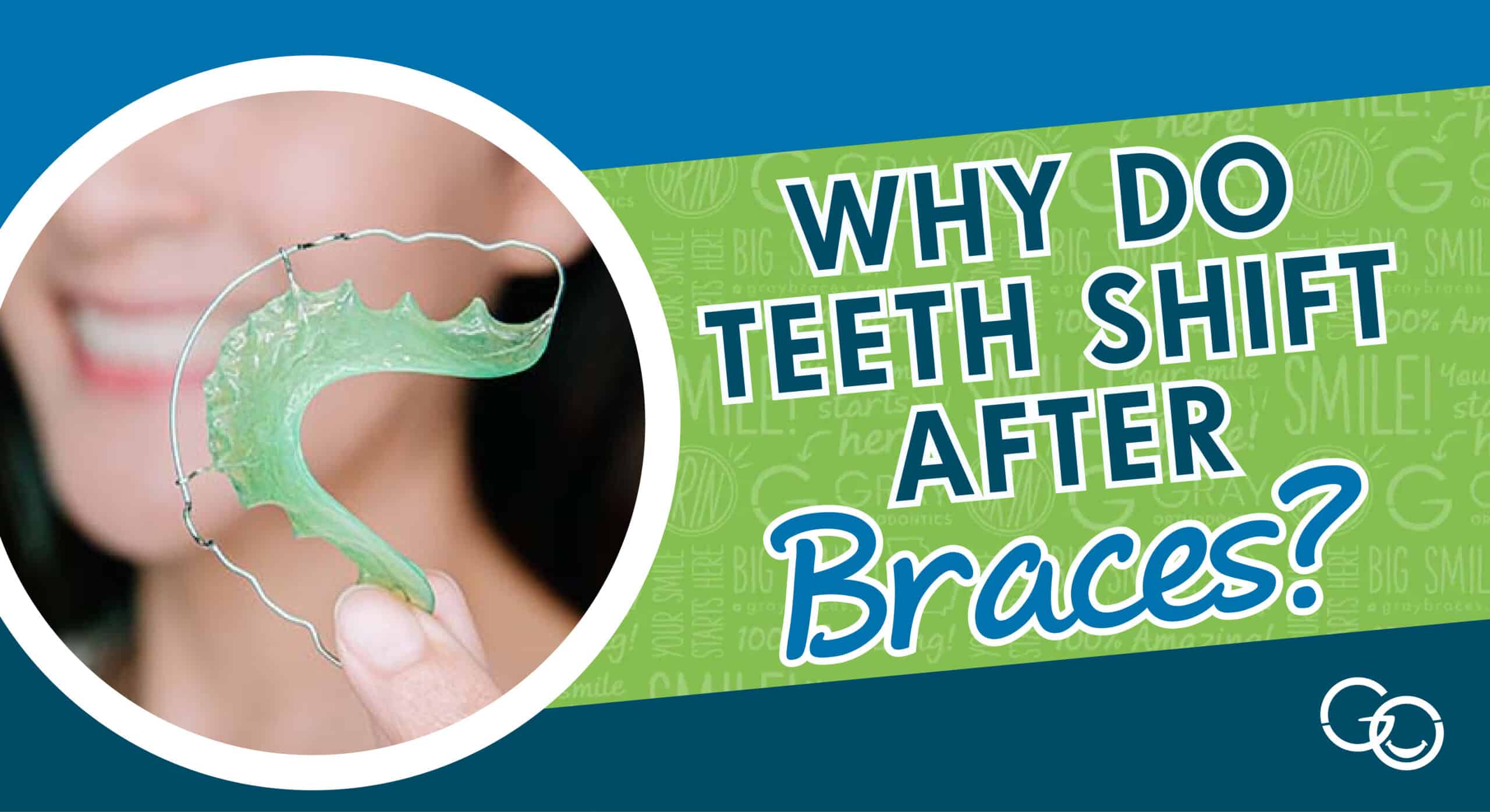 Why Teeth Shift After Braces
